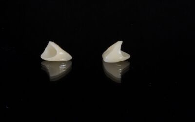 How to Pull Out a Tooth at Home Safely & Easily (No Pain)