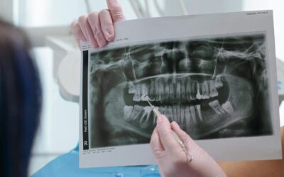 10 Early Signs of Tooth Infection Spreading to Body