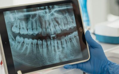 Symptoms of Tooth Infection Spreading to Body (Key Signs)