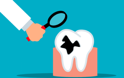 Cavity on Front Tooth: Causes, Treatment & How to Fix