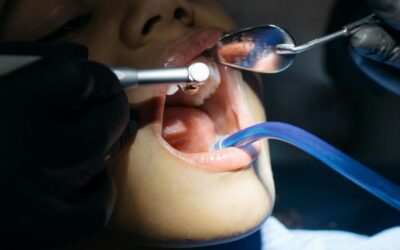 How Do You Know If You Need a Root Canal? Simple Guide